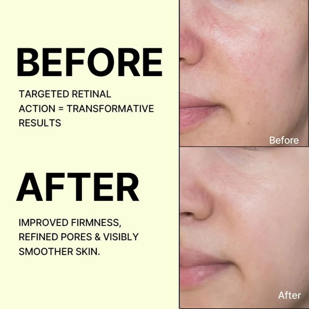 Buy 1 Get 1 Free Celimax The Vita-A Retinal Shot Tightening Booster, For Anti-Aging, Dark Spots & Wrinkles