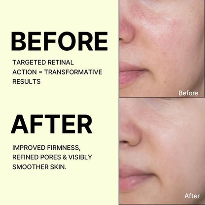 Buy 1 Get 1 Free Celimax The Vita-A Retinal Shot Tightening Booster, For Anti-Aging, Dark Spots & Wrinkles